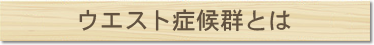 ウエスト症候群とは
